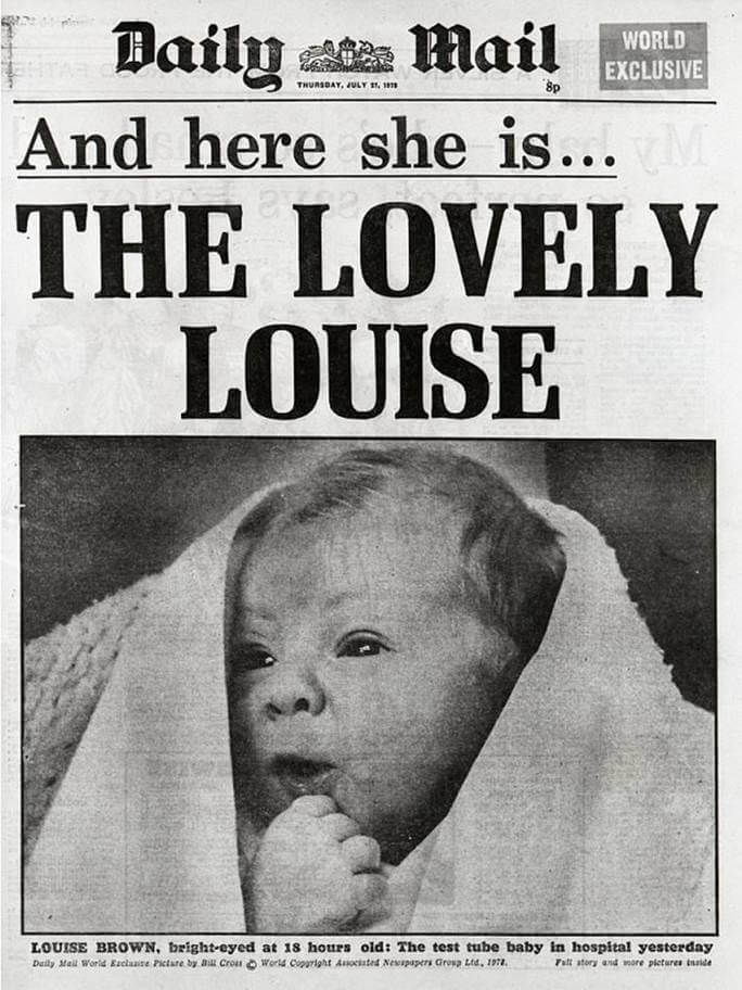 Une du Daily Mail du 27 juillet 1978 annonçant la naissance de Louise Brown, premier bébé conçu par fécondation in vitro (FIV), marquant une avancée majeure dans l'histoire de l'assistance médicale à la procréation (AMP).