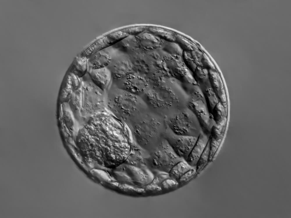Image microscopique d’un blastocyste prêt pour la congélation embryonnaire dans le cadre d’un traitement d’Assistance Médicale à la Procréation (AMP).